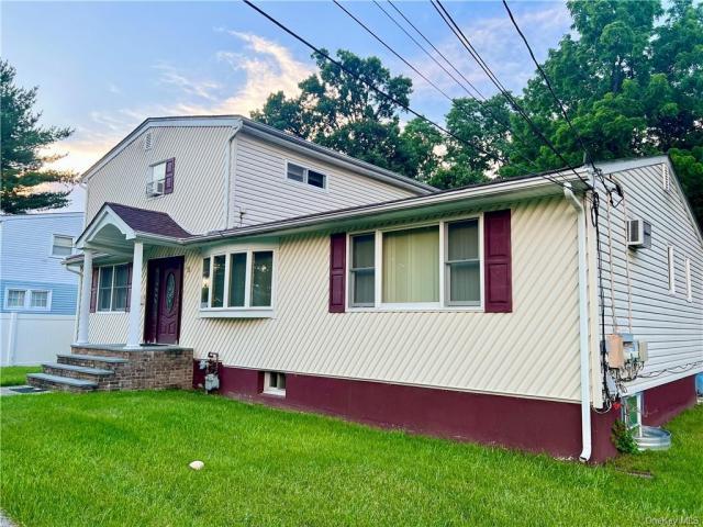 5 bedroom, Ramapo NY 10977 LS72692078